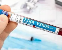 Suspected Zika case: Sample from Andhra sent to NIV Pune for confirmation